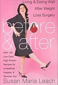 Before & After (Hardcover)