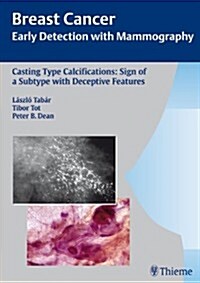 Casting-Type Calcifications: Sign of a Subtype with Deceptive Features (Hardcover)