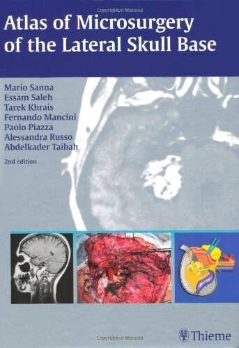 Atlas of Microsurgery of the Lateral Skull Base (Hardcover, 2nd)
