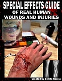 Special Effects Guide of Real Human Wounds and Injuries: Special Effects Guide of Real Human Wounds and Injuries (Paperback)