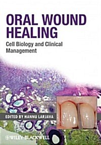 Oral Wound Healing: Cell Biology and Clinical Management (Hardcover)