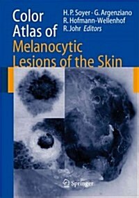 Color Atlas of Melanocytic Lesions of the Skin (Paperback, 1st)