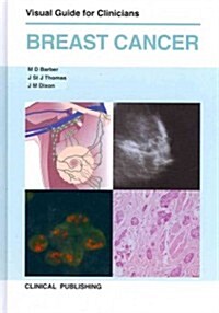 Breast Cancer : Visual Guide for Clinicians (Hardcover)