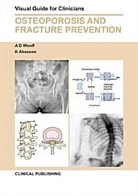 Post-Menopausal Osteoporosis: Visual Guide for Clinicians (Hardcover)