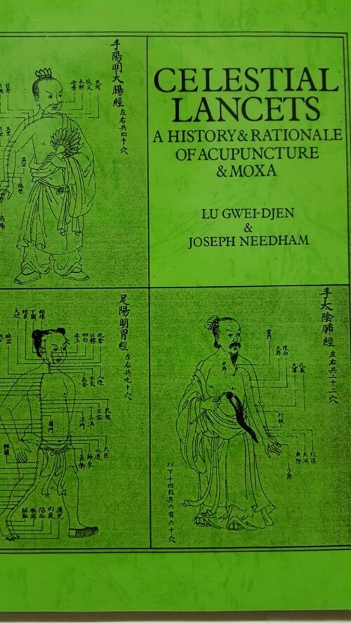 [중고] Celestial Lancets : A History and Rationale of Acupuncture and Moxa (Paperback)