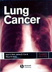 Lung Cancer (Hardcover, 3rd)