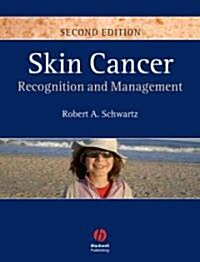 Skin Cancer : Recognition and Management (Hardcover, 2nd Edition)