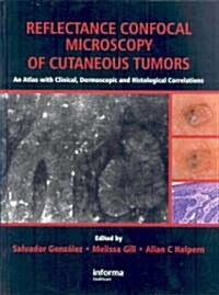 Reflectance Confocal Microscopy of Cutaneous Tumors : An Atlas with Clinical, Dermoscopic and Histological Correlations (Hardcover)