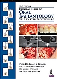Clinical Guide to Oral Implantology: Step by Step Procedures (Paperback, 3)