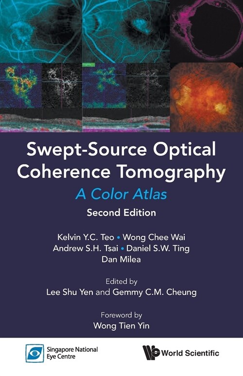 Swept-Source Optic Cohe (2nd Ed) (Paperback)