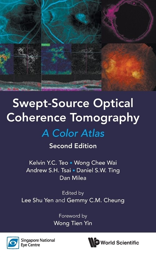 Swept-Source Optical Coherence Tomography: A Color Atlas (Second Edition) (Hardcover)