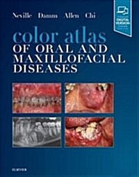 Color Atlas of Oral and Maxillofacial Diseases (Hardcover)