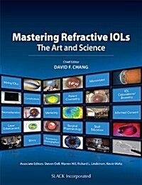 Mastering Refractive IOLs: The Art and Science (Hardcover)