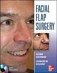 Facial Flaps Surgery (Hardcover, New)