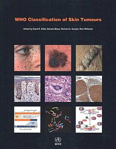 Who Classification of Skin Tumours (Paperback, 4)