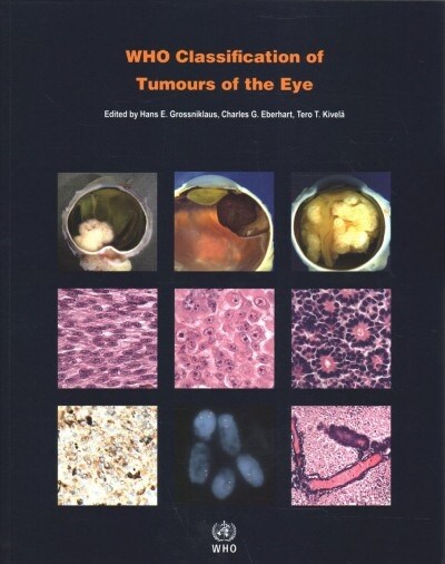 Who Classification of Tumours of the Eye (Paperback, 4)