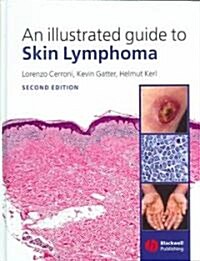 An Illustrated Guide to Skin Lymphoma (Hardcover, 2nd)