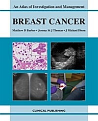 Breast Cancer (Hardcover)