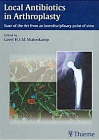 Local Antibiotics in Arthroplasty (Paperback, 1st)