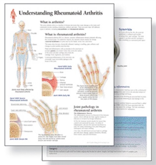 Understanding Arthritis Study Set Replacement Pads : Patient Education Study Sets (Paperback)