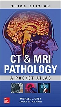 CT & MRI Pathology: A Pocket Atlas, Third Edition (Paperback, 3)