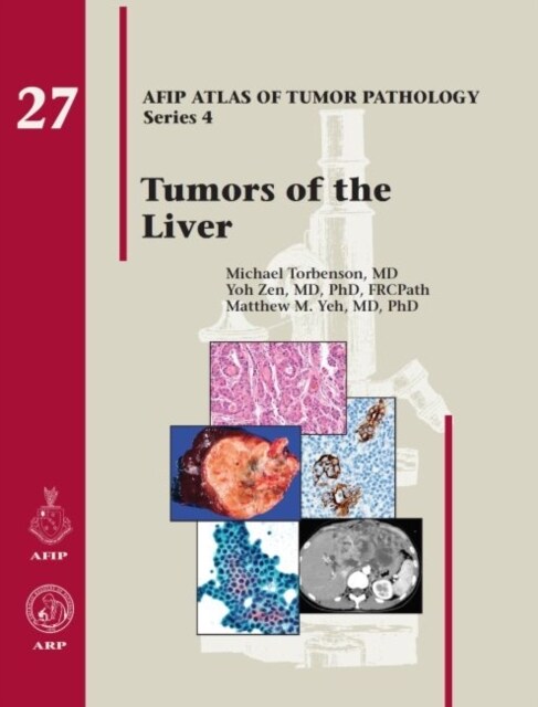 Tumors of the Liver (Hardcover)