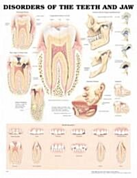 Disorders of the Teeth and Jaw Anatomical Chart (Paperback)