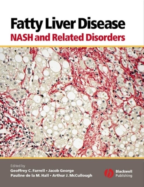 Fatty Liver Disease: Nash and Related Disorders (Hardcover)