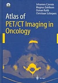 Atlas of Pet/CT Imaging in Oncology (Hardcover)
