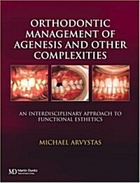 Orthodontic Management of Agenesis and Other Complexities : An Interdisciplinary Approach to Functional Esthetics (Hardcover)