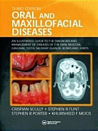 Oral and Maxillofacial Diseases: An Illustrated Guide to Diagnosis and Management of Diseases of the Oral Mucosa, Gingivae, Teeth, Salivary Glands, Bo (Hardcover, 3)