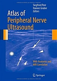 Atlas of Peripheral Nerve Ultrasound: With Anatomic and MRI Correlation (Hardcover, 2013)