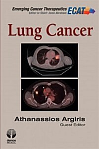 Lung Cancer (Hardcover, 1st)
