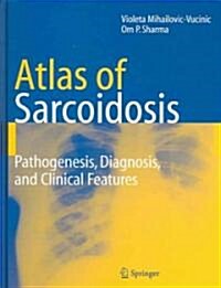 Atlas of Sarcoidosis : Pathogenesis, Diagnosis and Clinical Features (Hardcover)