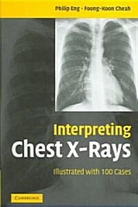 Interpreting Chest X-Rays : Illustrated with 100 Cases (Paperback)
