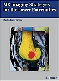 MR Imaging Strategies for the Lower Extremities (Hardcover)