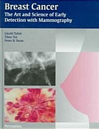 Breast Cancer - The Art and Science of Early Detection with Mammography: Perception, Interpretation, Histopathologic Correlation (Hardcover)