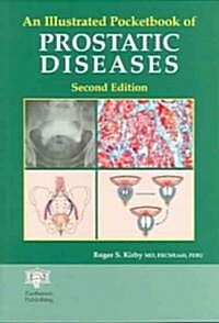 An Illustrated Pocketbook of Prostatic Disease (Paperback)