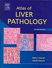Atlas of Liver Pathology (Hardcover, 2 Rev ed)