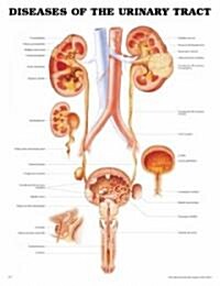 Diseases of the Urinary Tract Anatomical Chart (Other, 2)