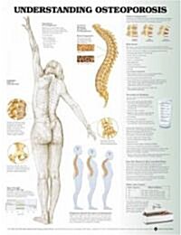 Understanding Osteoporosis Chart (Chart, 1st)