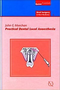 Practical Dental Local Anaesthesia (Hardcover, 1st)