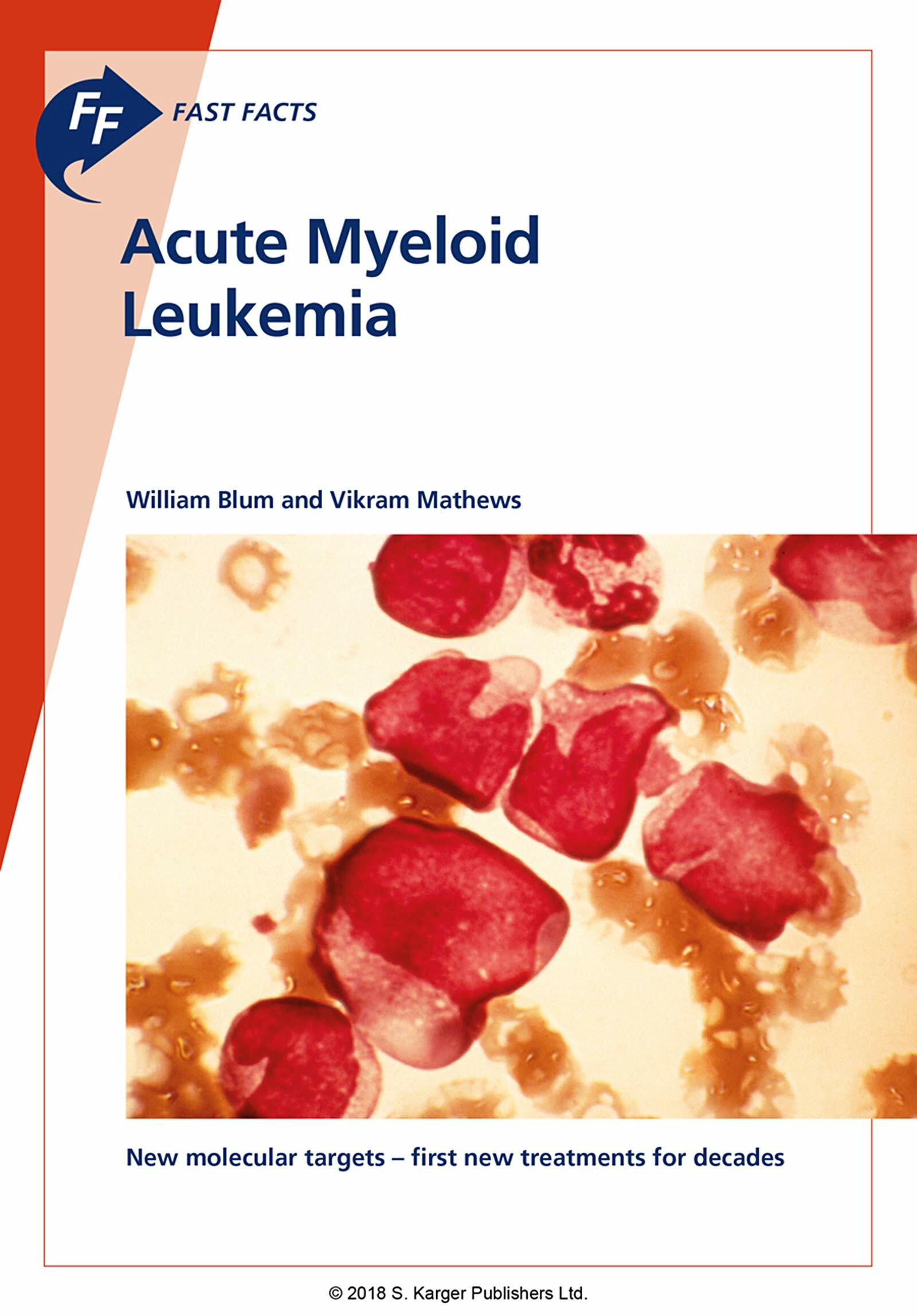 Fast Facts: Acute Myeloid Leukemia (Paperback)