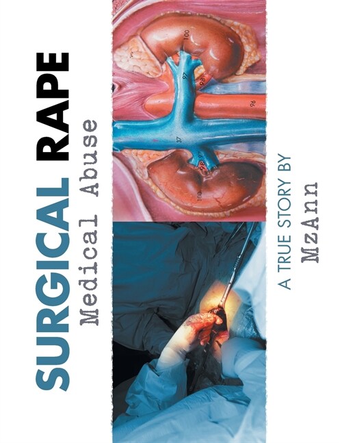 Surgical Rape: Medical Abuse (Paperback)