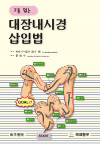 (고통 없는) 대장내시경 삽입법