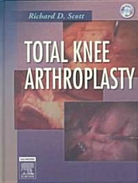 Total Knee Arthroplasty (Hardcover)