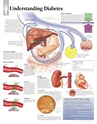 Understanding Diabetes Chart: Laminated Wall Chart (Other)