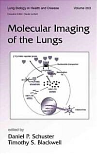 Molecular Imaging of the Lungs (Hardcover)