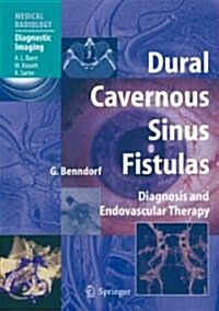 Dural Cavernous Sinus Fistulas: Diagnosis and Endovascular Therapy (Hardcover)