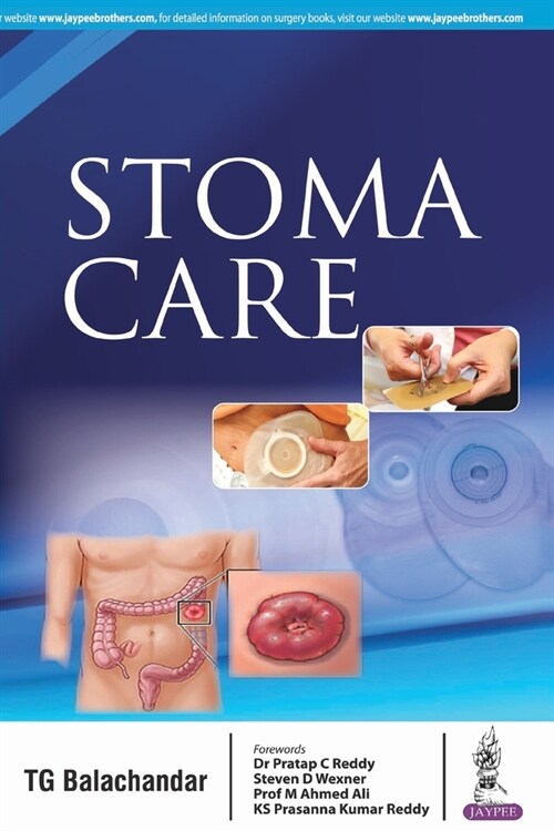 Stoma Care (Paperback)